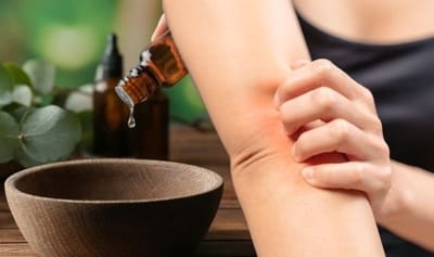 dermatita-alergica dermatita-alergica